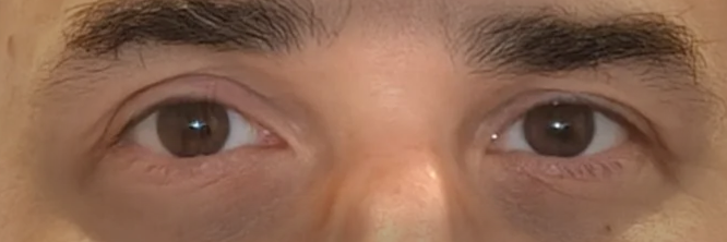 Approved eyes-only preview for Rich